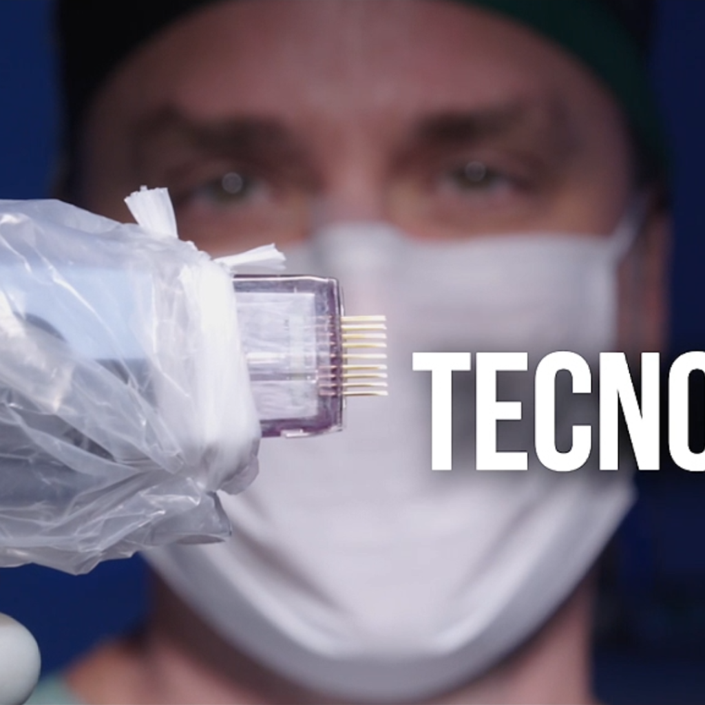 vídeo institucional procedimento lipo HD — Clínica Proto em Vinhedo